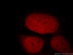 STAG2 Antibody in Immunocytochemistry (ICC/IF)