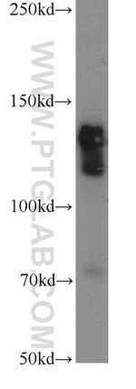 STAG2 Antibody in Western Blot (WB)