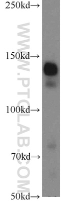 STAG2 Antibody in Western Blot (WB)