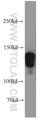 STAG2 Antibody in Western Blot (WB)