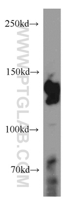 STAG2 Antibody in Western Blot (WB)
