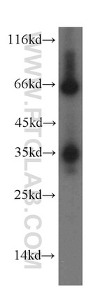 TMX2 Antibody in Western Blot (WB)
