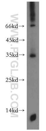 TMX2 Antibody in Western Blot (WB)