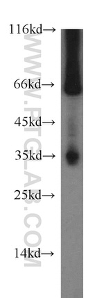 TMX2 Antibody in Western Blot (WB)