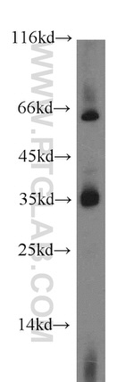 TMX2 Antibody in Western Blot (WB)