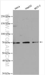 ZNF26 Antibody in Western Blot (WB)