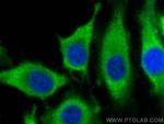 CENPM Antibody in Immunocytochemistry (ICC/IF)