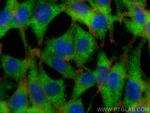 CENPM Antibody in Immunocytochemistry (ICC/IF)