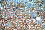 CALCOCO1 Antibody in Immunohistochemistry (Paraffin) (IHC (P))