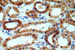 CALCOCO1 Antibody in Immunohistochemistry (Paraffin) (IHC (P))