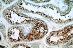 CALCOCO1 Antibody in Immunohistochemistry (Paraffin) (IHC (P))
