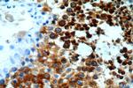 CALCOCO1 Antibody in Immunohistochemistry (Paraffin) (IHC (P))