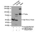 SP140L Antibody in Immunoprecipitation (IP)