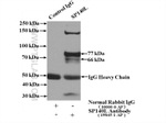 SP140L Antibody in Immunoprecipitation (IP)