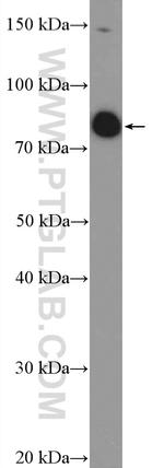 SP140L Antibody in Western Blot (WB)