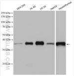 TMEM173/STING Antibody in Western Blot (WB)