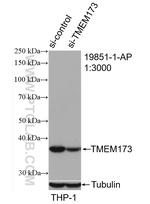 TMEM173/STING Antibody in Western Blot (WB)