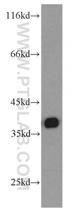 TMEM173/STING Antibody in Western Blot (WB)