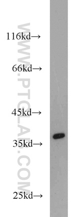 TMEM173/STING Antibody in Western Blot (WB)