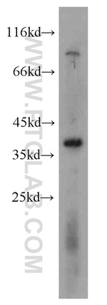 TMEM173/STING Antibody in Western Blot (WB)