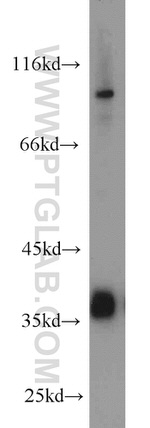 TMEM173/STING Antibody in Western Blot (WB)