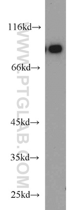 TMEM173/STING Antibody in Western Blot (WB)