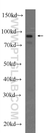 TMEM173/STING Antibody in Western Blot (WB)