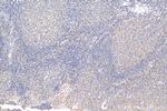 PCM1 Antibody in Immunohistochemistry (Paraffin) (IHC (P))