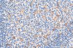 PCM1 Antibody in Immunohistochemistry (Paraffin) (IHC (P))