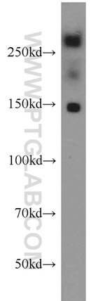 PCM1 Antibody in Western Blot (WB)