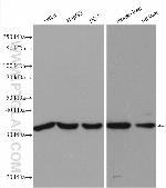 Spermidine synthase Antibody in Western Blot (WB)