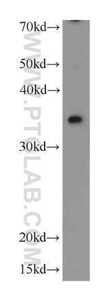 ALKBH4 Antibody in Western Blot (WB)