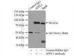 APPL1 Antibody in Immunoprecipitation (IP)