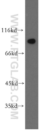 APPL1 Antibody in Western Blot (WB)