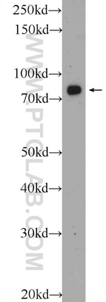 APPL1 Antibody in Western Blot (WB)