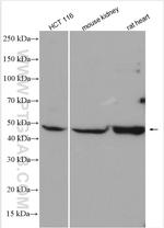 PHD2 Antibody in Western Blot (WB)
