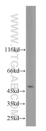 PHD2 Antibody in Western Blot (WB)