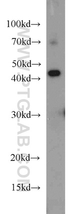 PHD2 Antibody in Western Blot (WB)