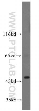 PHD2 Antibody in Western Blot (WB)