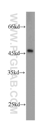PHD2 Antibody in Western Blot (WB)