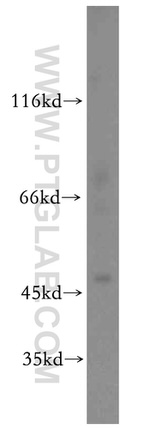 PHD2 Antibody in Western Blot (WB)