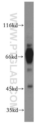 PHD2 Antibody in Western Blot (WB)