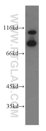 ILF3 Antibody in Western Blot (WB)