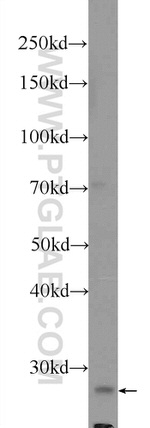 COX4NB Antibody in Western Blot (WB)