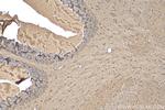 SNRNP25 Antibody in Immunohistochemistry (Paraffin) (IHC (P))