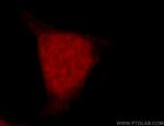 RFWD3 Antibody in Immunocytochemistry (ICC/IF)