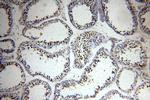 RFWD3 Antibody in Immunohistochemistry (Paraffin) (IHC (P))