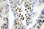 RFWD3 Antibody in Immunohistochemistry (Paraffin) (IHC (P))