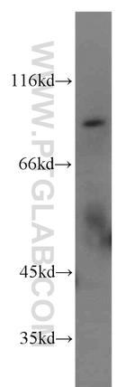 RFWD3 Antibody in Western Blot (WB)