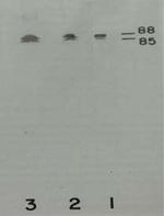 Prekallikrein Heavy Chain Antibody in Western Blot (WB)